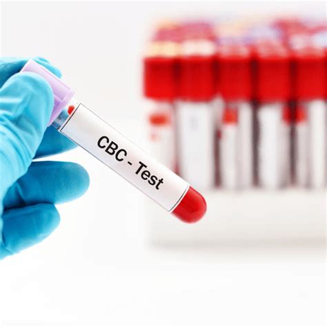 Understanding Blood Counts in Leukemia.